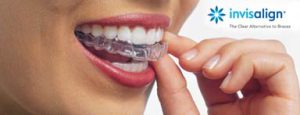 Invisalign Dentist Clarkson Mississauga